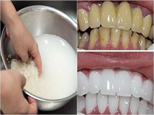 Bí quyết giúp răng trắng tinh từ nguyên liệu có sẵn trong bếp ảnh 1 Bí quyết giúp răng trắng tinh từ nguyên liệu có sẵn trong bếp ảnh 1
