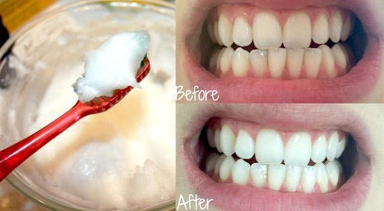 Bí quyết giúp răng trắng tinh từ nguyên liệu có sẵn trong bếp ảnh 4 Bí quyết giúp răng trắng tinh từ nguyên liệu có sẵn trong bếp ảnh 4