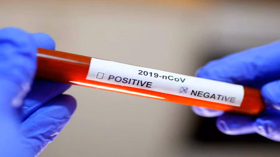 Hai trường hợp nghi ngờ nhiễm COVID-19 đã có kết quả âm tính với SARS-CoV-2