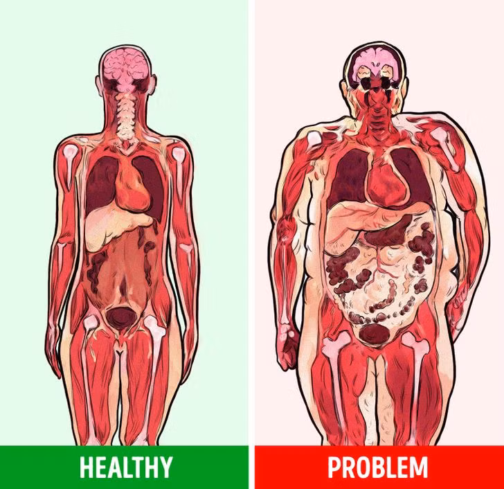 Mỡ bụng nguy hiểm thế nào đối với sức khỏe? ảnh 1