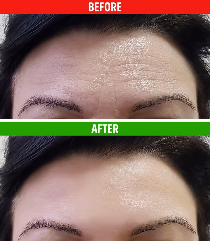 5 loại tinh dầu giúp chống lại nếp nhăn hiệu quả nhất, bạn đã biết chưa? ảnh 2