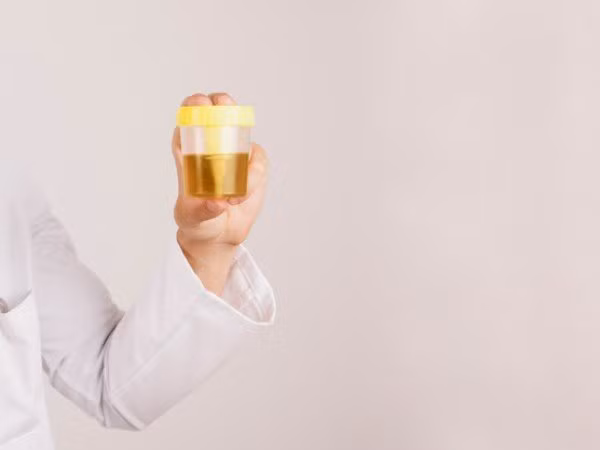 Sự thật việc uống nước tiểu giúp chữa bệnh ảnh 1