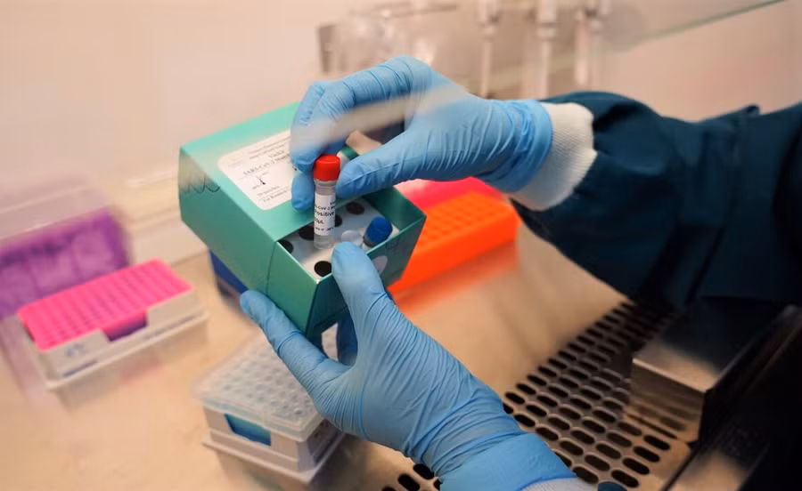 Vinmec phát triển thành công 02 bộ Kit phát hiện và chẩn đoán virus SARS-CoV-2 ảnh 2