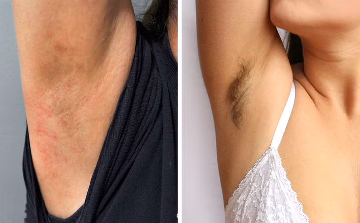 5 lợi ích bất ngờ của việc không cạo lông nách