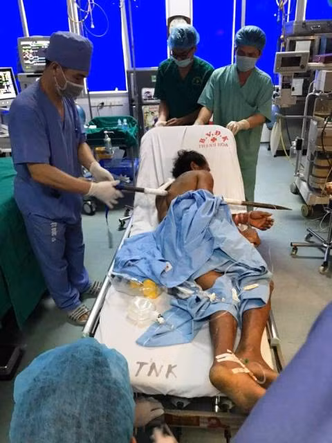 Thanh Hóa: Người đàn ông bị xà beng đâm thấu ngực ảnh 1