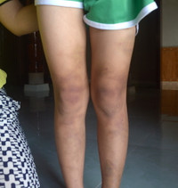 Quảng Bình: Bé gái 8 tuổi bị đòn roi tàn bạo từ bố đẻ ảnh 2 Quảng Bình: Bé gái 8 tuổi bị đòn roi tàn bạo từ bố đẻ ảnh 2