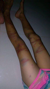 Quảng Bình: Bé gái 8 tuổi bị đòn roi tàn bạo từ bố đẻ ảnh 4 Quảng Bình: Bé gái 8 tuổi bị đòn roi tàn bạo từ bố đẻ ảnh 4