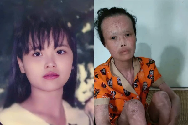 Đẫm nước mắt trước tình cảnh của cô giáo bạc mệnh 