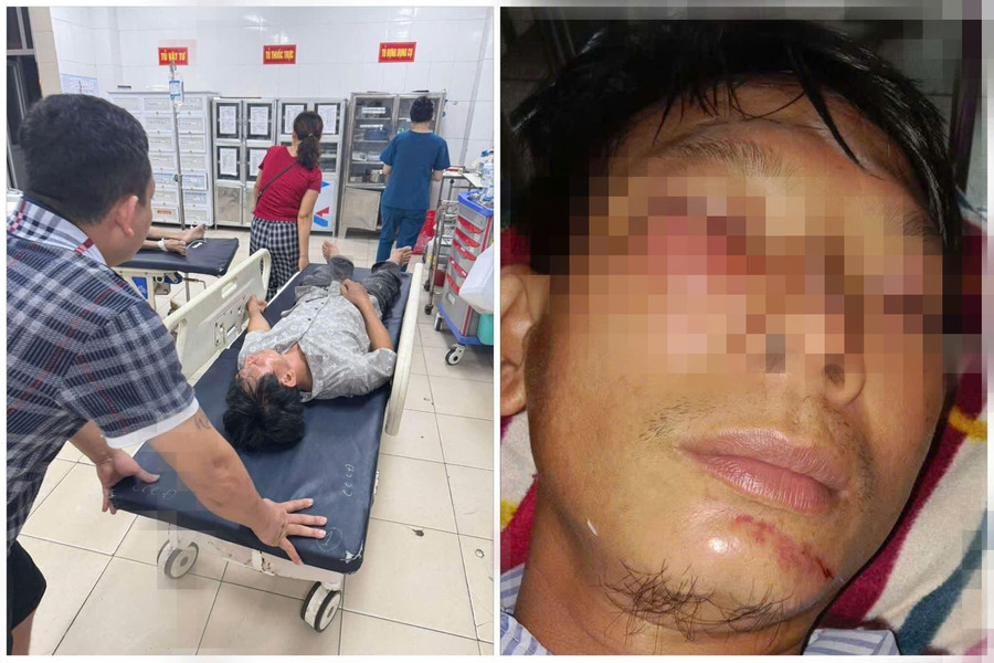 Anh H. bị chấn thương nặng đang được điều trị, theo dõi tại Bệnh viện Đa khoa Hà Tĩnh. 8c3a7a116302d75c8e13.jpg