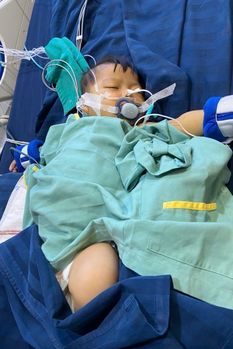 Bé Khánh Vy với chi chít ống dẫn sau phẫu thuật khiến ai ai cũng xót xa, thương cảm. 6.jpg
