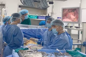 Các bác sĩ thực hiện cắt bỏ khối u bằng phương pháp phẫu thuật nội soi. Ảnh: BVCC. 