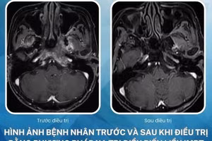 Sau 15 tháng theo dõi, sức khỏe của bệnh nhân ổn định, không có dấu hiệu tái phát hay biến chứng nghiêm trọng. Ảnh: BVCC.