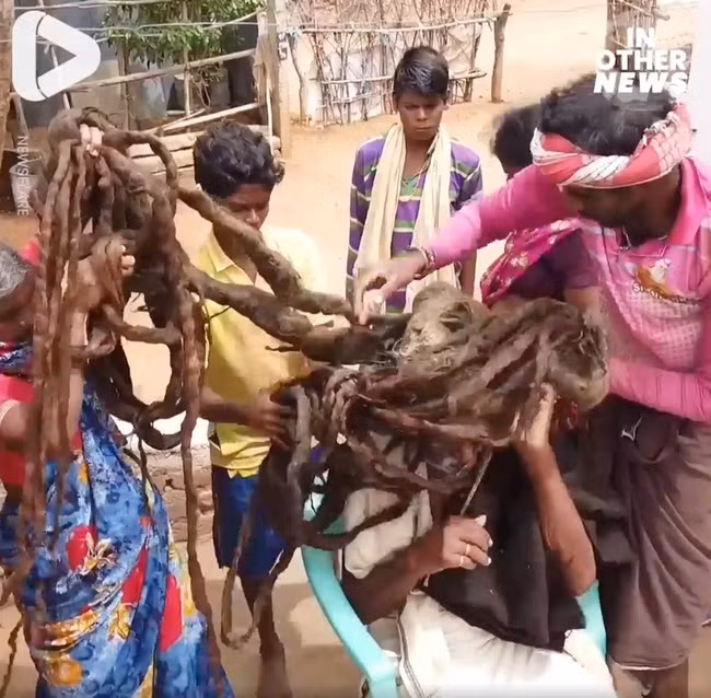 Mọi người xúm lại gỡ tóc giúp ông Doddapalliah.