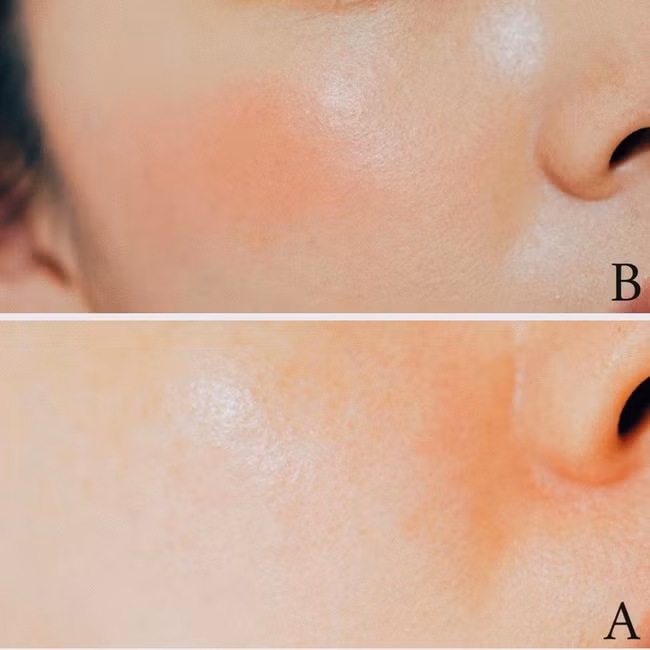 Bác sĩ bật mí 5 mẹo rửa mặt cho da sạch đến từng lỗ chân lông, theo thời gian da càng thêm tươi sáng mịn màng - Ảnh 4.