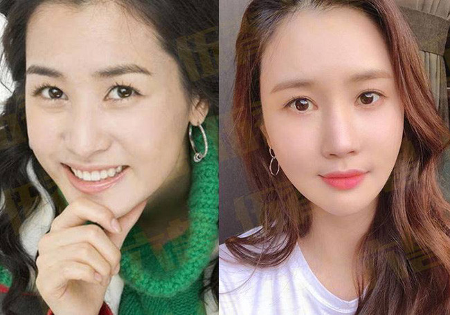 Với bộ phim My girl, Lee Da Hae trở thành nữ diễn viên hàng đầu của Hàn Quốc. Dù xinh đẹp nhưng Lee Da Hae vẫn luôn cố gắng khiến bản thân phải thật hoàn hảo bằng những cuộc phẫu thuật thẩm mỹ, làm cho gương mặt trở nên đơ cứng. Những năm qua Lee Da Hae không còn hoạt động nhiều trong showbiz, cô chuyển hướng sang làm blogger.