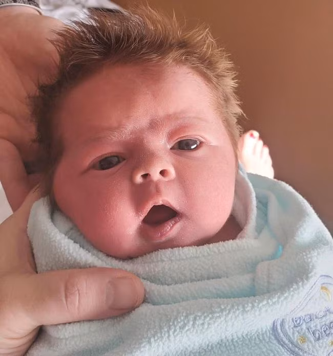 Có trẻ sinh ra đã sở hữu mái tóc dày như bờm sư tử, có bé chỉ có 1 chỏm tóc, vì sao lại vậy? - Ảnh 6.