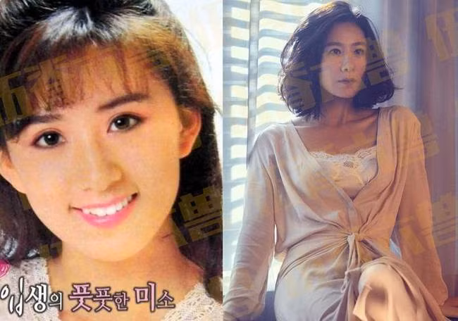 Đóng phim khi còn ngồi trên ghế nhà trường, Kim Hee Ae nhanh chóng trở thành diễn viên nổi tiếng cuối thập niên 80 và đầu thập niên 90. Mặc dù ngoại hình không phải lợi thế của Kim Hee Ae nhưng diễn xuất của cô đã chinh phục được khán giả. Bộ phim "Thế giới hôn nhân" mới đây của cô đã gây sốt trong suốt khoảng thời gian chiếu.