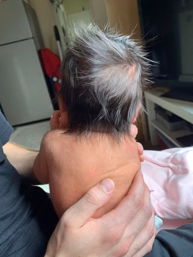 Có trẻ sinh ra đã sở hữu mái tóc dày như bờm sư tử, có bé chỉ có 1 chỏm tóc, vì sao lại vậy? - Ảnh 4.