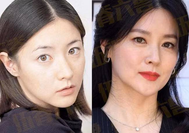 Vai diễn Dae Jang Geum đã giúp Lee Young Ae nổi tiếng toàn châu Á. Là một ngôi sao xinh đẹp và tài năng, lại gần như không có scandal kể từ khi vào nghề, Lee Young Ae rất được lòng netizen xứ Hàn. Mấy năm nay, Lee Young Ae cũng không còn đóng phim nhiều, cô chủ yếu dành thời gian chăm sóc cho gia đình nhỏ.