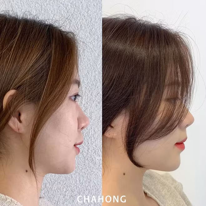 Loạt chiêu làm tóc khi đến salon giúp bạn trẻ hơn ít nhất 5 tuổi ảnh 8 Loạt chiêu làm tóc khi đến salon giúp bạn trẻ hơn ít nhất 5 tuổi ảnh 8