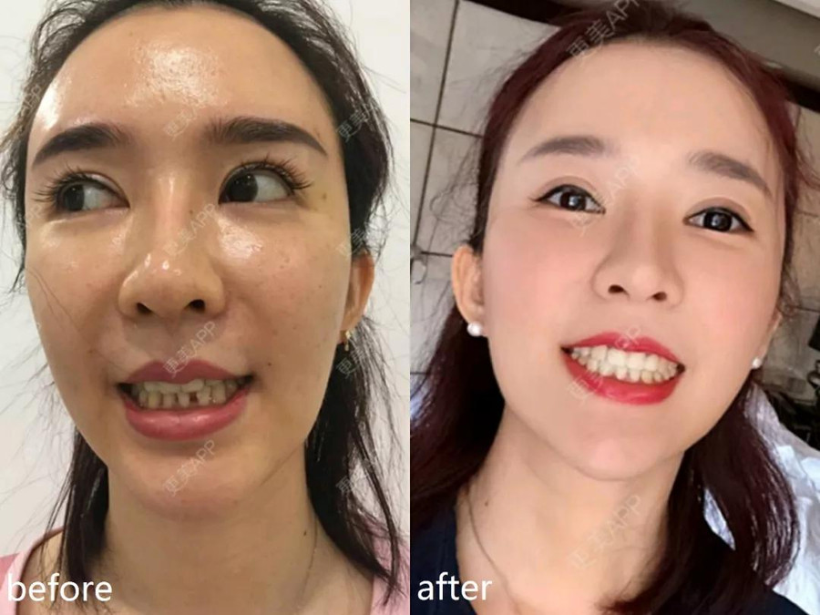 Chị em chỉ cần thay đổi 4 điểm này là nhan sắc thăng hạng, &quot;chấp&quot; hết tất cả mọi kiểu thẩm mỹ trên đời - Ảnh 4.