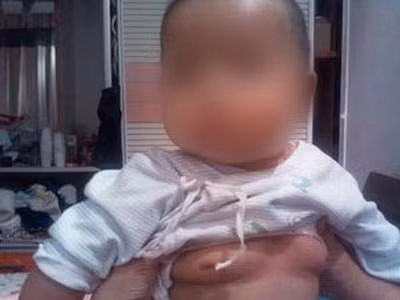 Ở nước ta tình trạng trẻ gái dậy thì sớm chiếm tỷ lệ cao hơn trẻ nam.