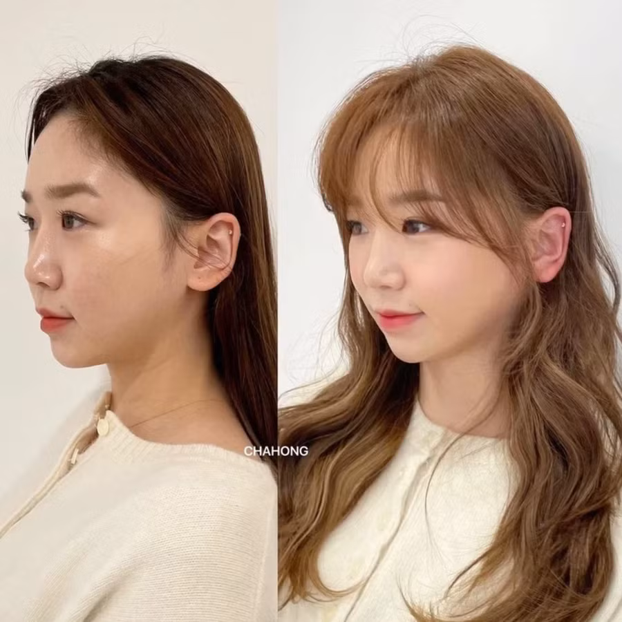 Bạn mà chưa biết đến 6 kiểu tóc che sạch khuyết điểm gương mặt này thì chẳng trách tại sao visual chưa okela! - Ảnh 6.