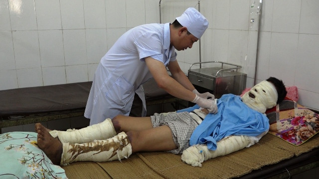 Một trong 5 nạn nhân bị bỏng rất nặng sau vụ nổ.