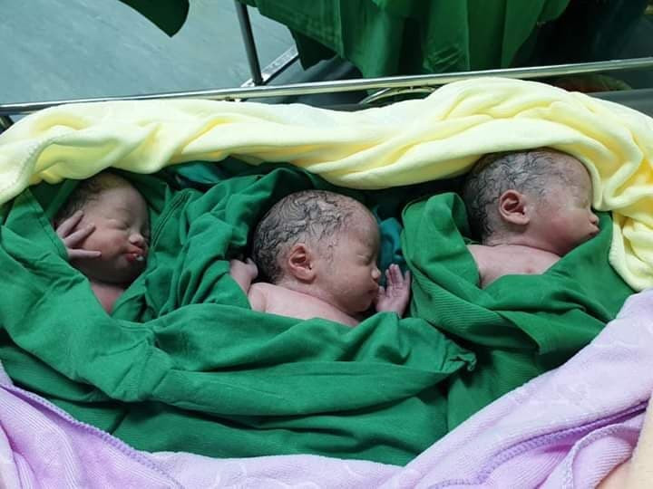 Siêu âm thai đôi, nhưng kết quả sinh ba Siêu âm thai đôi, nhưng kết quả sinh ba