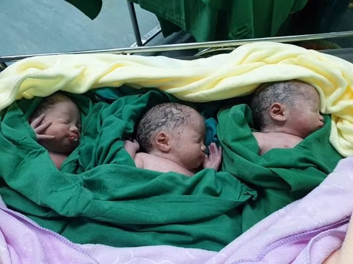 Siêu âm thai đôi, nhưng kết quả sinh ba