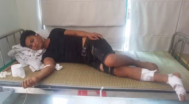 Tài xế Lê Văn Tùng đang được điều trị tại Phòng khám Đa khoa Tuấn Linh, Tĩnh Gia.