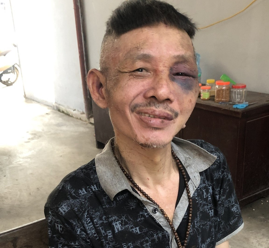 Đối tượng Nam bị bắt vì hành vi gây rối trật tự công cộn. Ảnh: Công an tỉnh Vĩnh Phúc