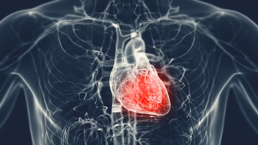 U nhầy thất trái cực kỳ hiếm gặp, chỉ chiếm khoảng 1-2% các trường hợp u nhầy tim được ghi nhận trên thế giới. Ảnh: ITN