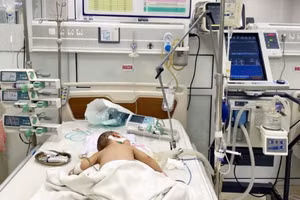 Bệnh nhi Đ.B.A. bị suy hô hấp cấp tiến triển (ARDS) do biến chứng cúm A.