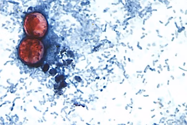 Hai nang bào tử Cyclospora cayetanensis.