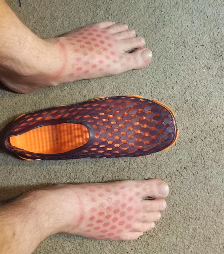 20 Pics of People Who Took Tanning Too Far and Were “Truly Marked”