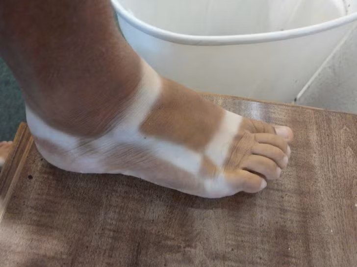 20 Pics of People Who Took Tanning Too Far and Were “Truly Marked”