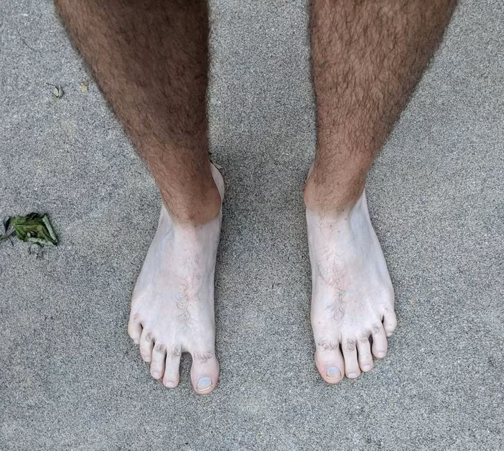 20 Pics of People Who Took Tanning Too Far and Were “Truly Marked”