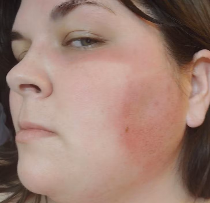 20 Pics of People Who Took Tanning Too Far and Were “Truly Marked”