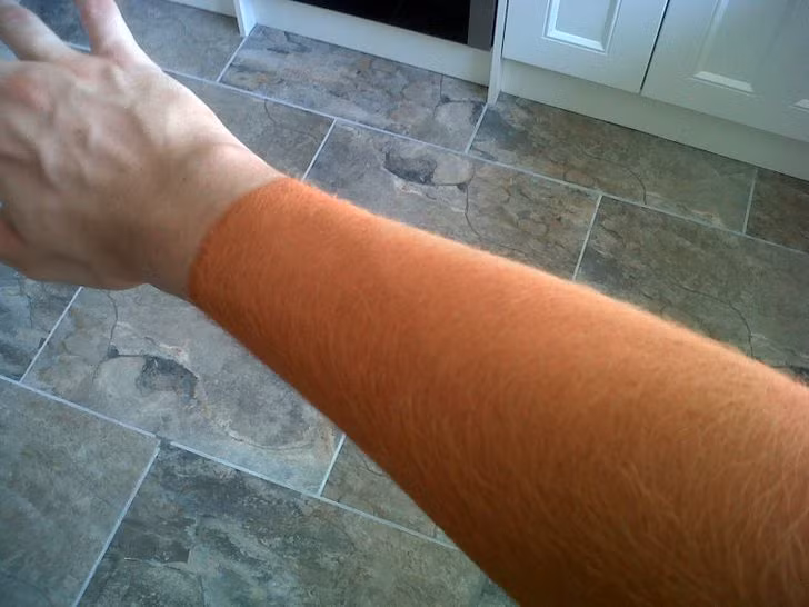 20 Pics of People Who Took Tanning Too Far and Were “Truly Marked”
