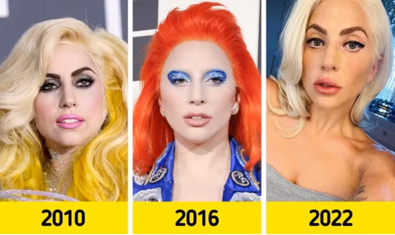 Nữ ca sĩ Lady Gaga. Nhan sắc dàn mỹ nhân Hollywood thay đổi ra sao sau khi nổi tiếng?