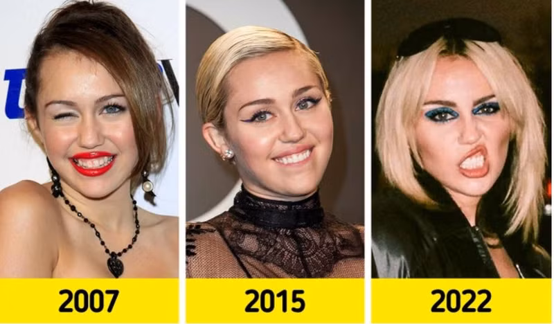 Nữ ca sĩ Miley Cyrus. Nhan sắc dàn mỹ nhân Hollywood thay đổi ra sao sau khi nổi tiếng?