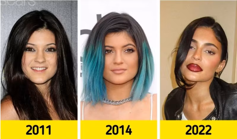 Người mẫu, nữ doanh nhân Kylie Jenner. Nhan sắc dàn mỹ nhân Hollywood thay đổi ra sao sau khi nổi tiếng?