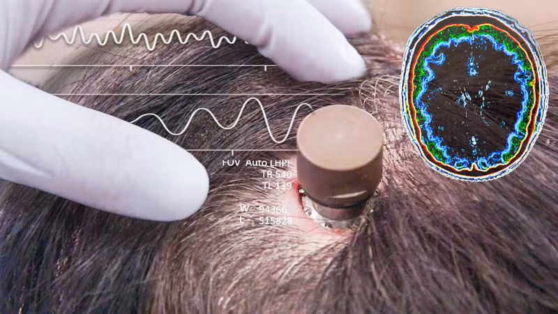 Trước đó, FDA đã từ chối đơn đăng ký của Neuralink, đồng thời đưa ra một số lo ngại cần được giải quyết trước khi cấp phép cho các thử nghiệm trên người. Tỷ phú Elon Musk công bố sắp cấy chip vào não người