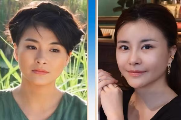 NSƯT Kim Oanh trẻ đẹp ngỡ ngàng sau phẫu thuật thẩm mỹ 