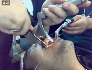 Sự cố của thợ sửa xe Sự cố của thợ sửa xe