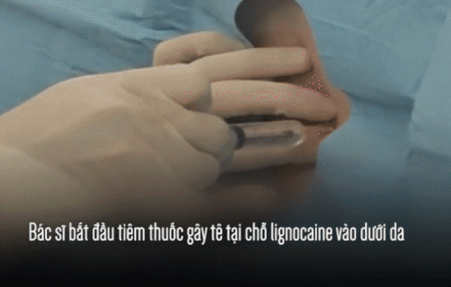 Chứng kiến quá trình gây tê tủy sống trước khi sinh mổ, chị em bảo nhau: “Thôi cố gắng đẻ thường!”