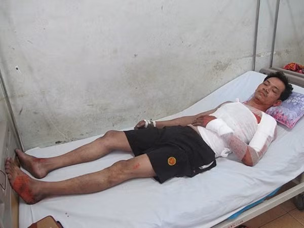 Vụ nổ lò luyện thép: Nạn nhân kể lại giây phút bị “thổi bay”