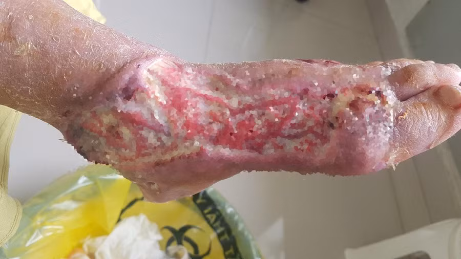 Kinh hoàng căn bệnh được ví như 