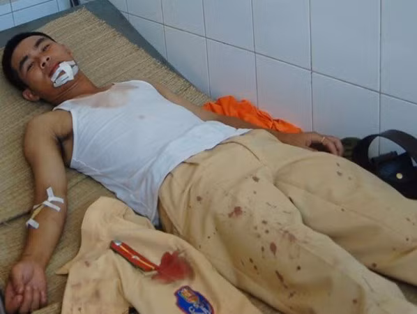 Thiếu úy Hiếu tại bệnh viện 198 (Ảnh: CQCN cung cấp)